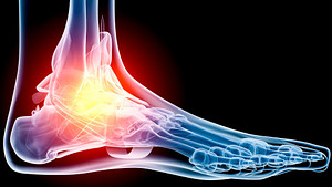 Skeletal view of the foot showing pain in the ankle joint.