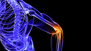 Elbow pain in a skeletal view of the arm.