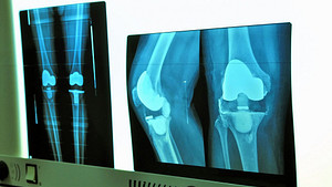 Knee x-ray