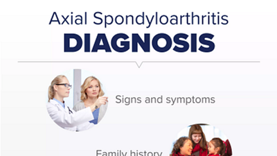 Axial Spondy Clinical Profile