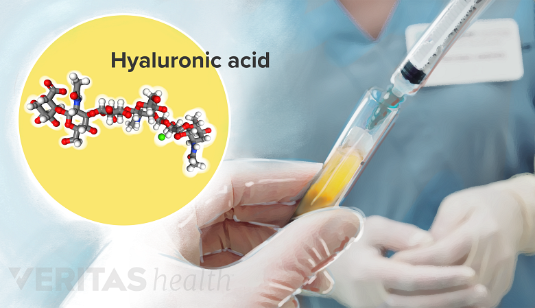 Medical illustration showing compound of Hyaluronic Acid.