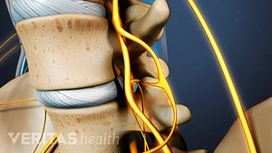 Medical illustration showing nerve roots in the spine exiting through the foramen.