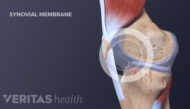 Medical illustration of the synovial membrane in the knee
