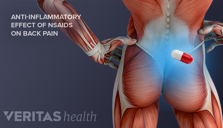 Effect of NSAID on lower back pain.