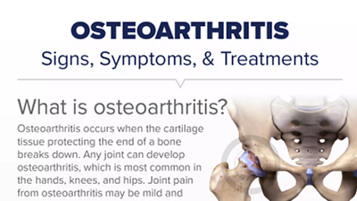 Osteoarthritis