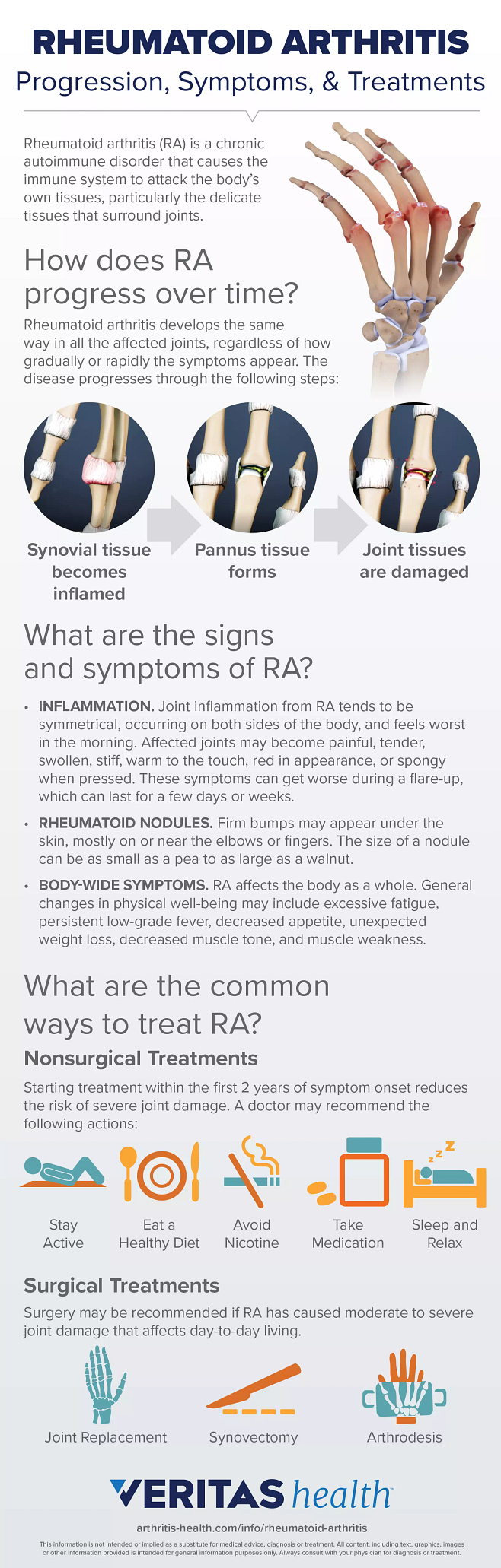 Rheumatoid Arthritis