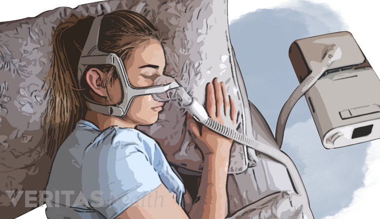 Woman sleeping with a CPAP on.