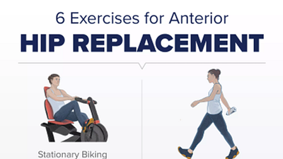 6 Exercises for Anterior Hip Replacement
